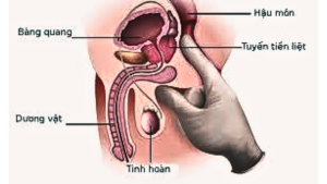 Chuẩn đoán phì đại tuyến tiền liệt