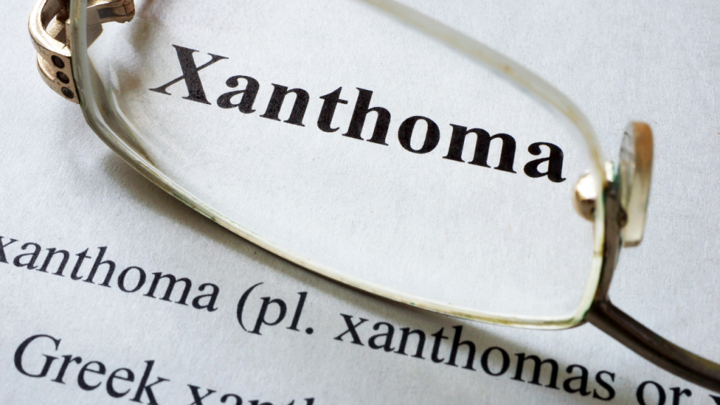 Xanthoma